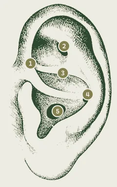 Schéma d’une oreille situant les cinq points du protocole NADA, numérotés de 1 à 5
